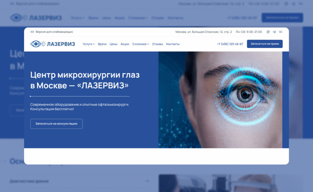 Лазервиз